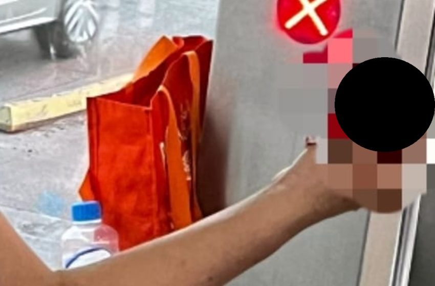  Horror en RUTA: Puerta de Autobús Amputa Parcialmente el Pulgar de una Poblana