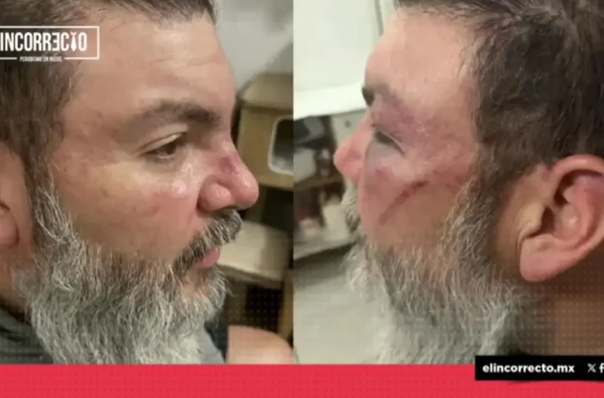  Aficionados del Cruz Azul golpean brutalmente a conductor de Sicom y a su cuñado afuera del Cuauhtémoc