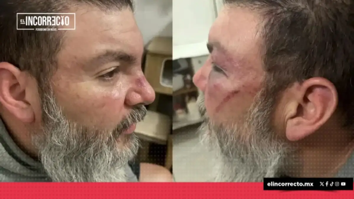 Aficionados del Cruz Azul golpean brutalmente conductor de Sicom y a su cuñado afuera del Cuauhtémoc
