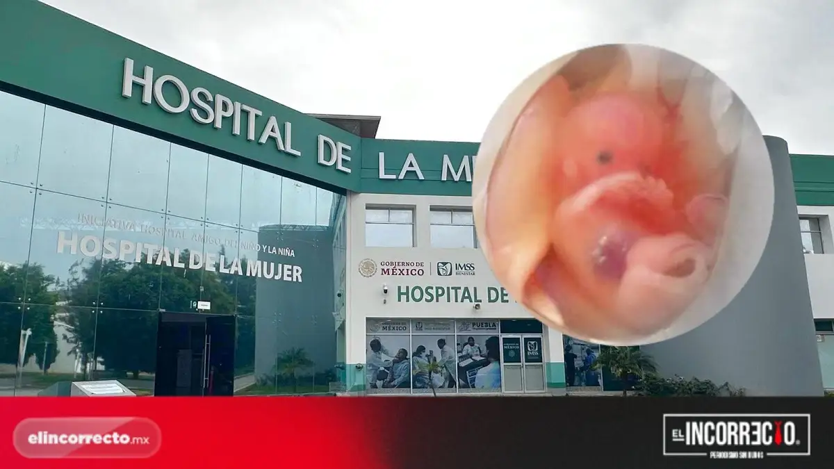 En 2025, se practican 427 abortos en Puebla