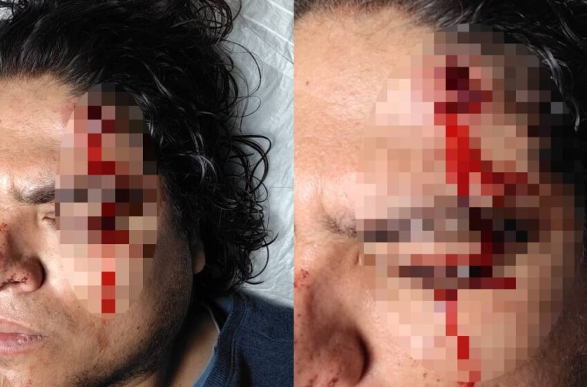  Ruta 17 bajo terror: editor de E-Consulta golpeado y asaltado por cinco delincuentes