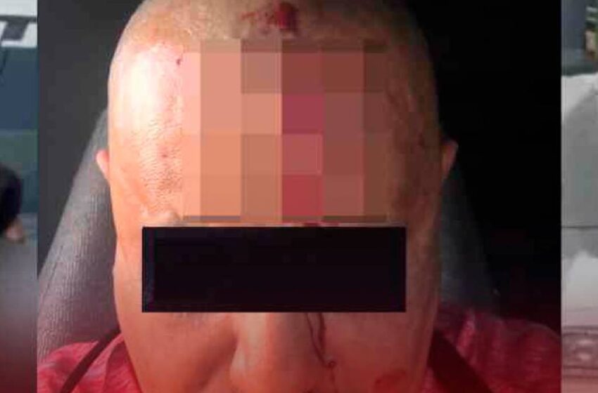  Nuevo tirador en Puebla: automovilista recibe impacto de bala en la cabeza sobre Amozoc-Esperanza